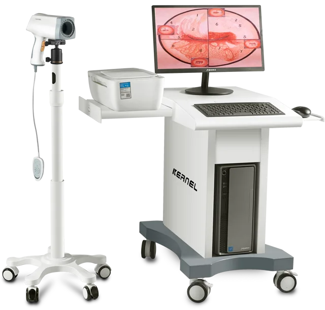 Colposcope Digital Imaging System