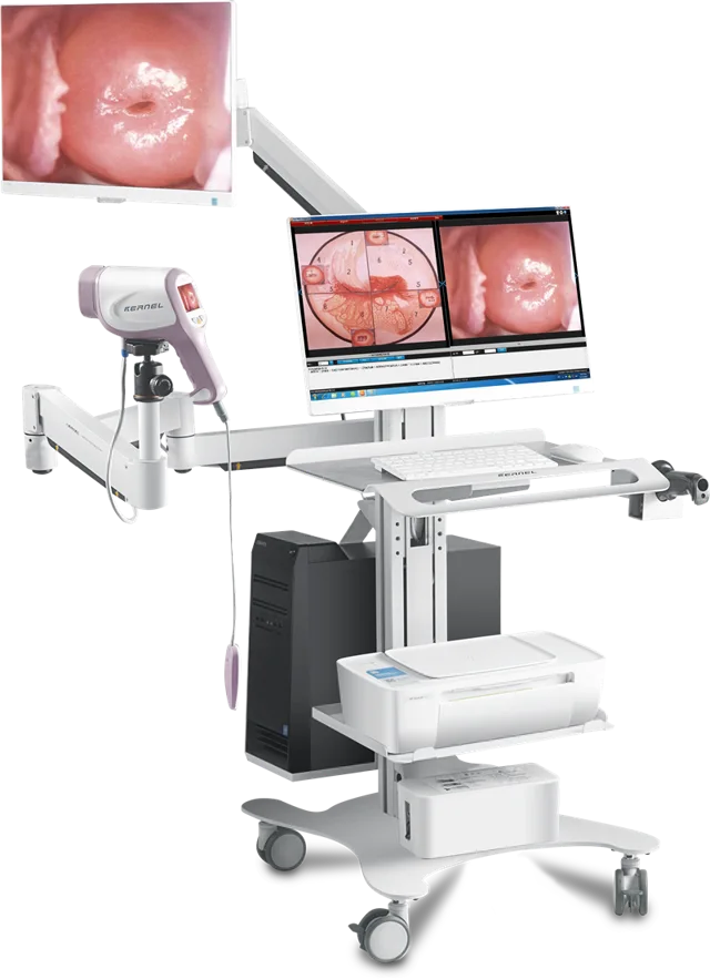 Colposcope Digital Imaging System Kn-2200i
