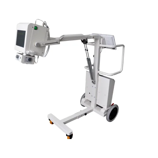 Digital Mobile X-ray System