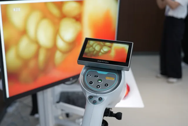 GN-500 HD Digital Video Colposcope for Cervical Screening and Gynecological Examination